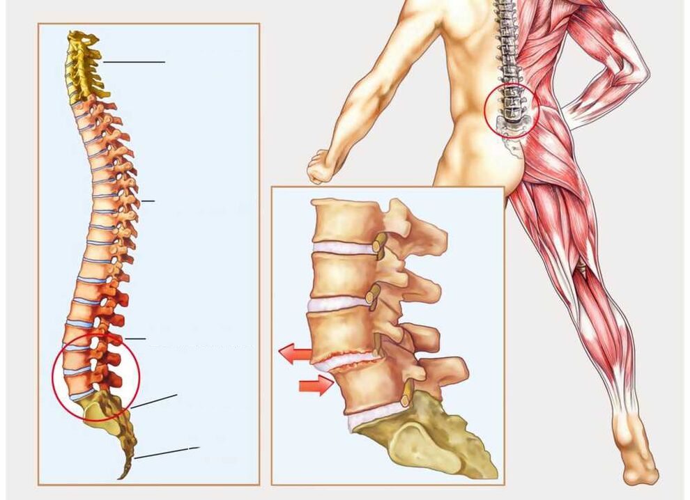bizkarrezurra osasuntsua eta gaixoa