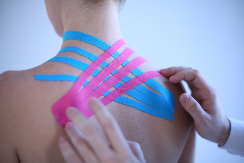 kinesiotaping bizkarrezurreko osteokondrosirako
