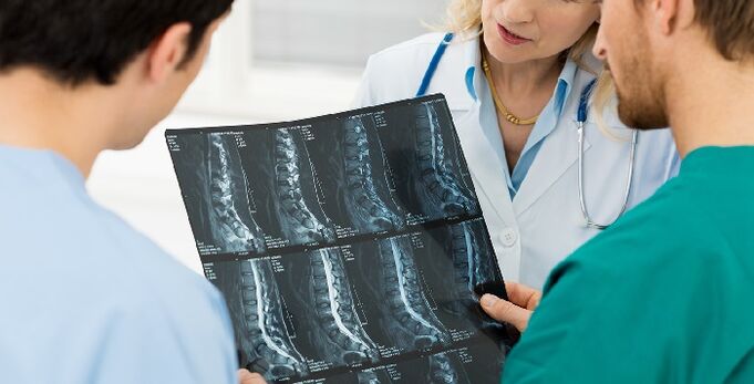 Bizkarrezurreko erradiografia osteokondrosia diagnostikatzeko modu gisa